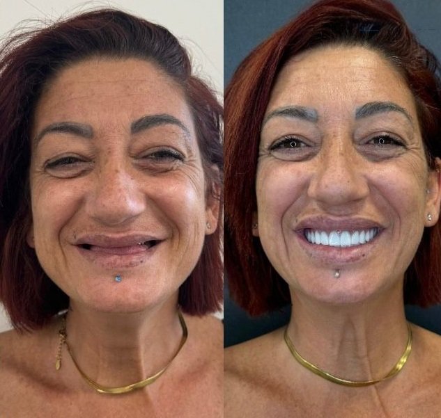 Patient Result