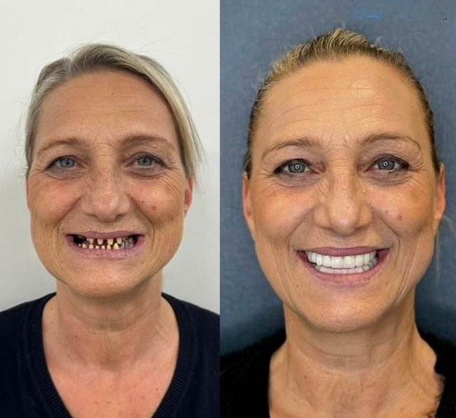 Patient Result