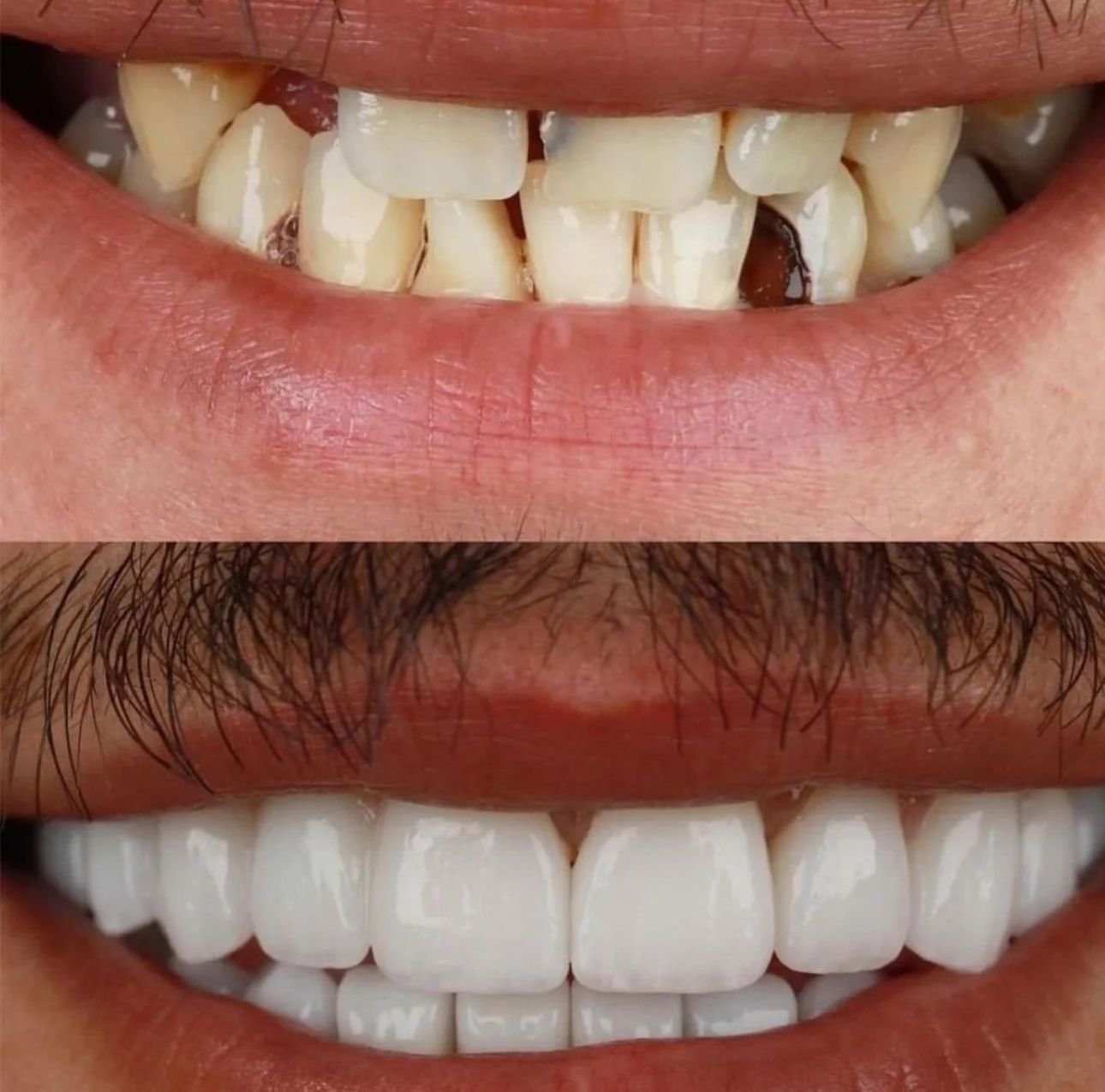 Patient Result