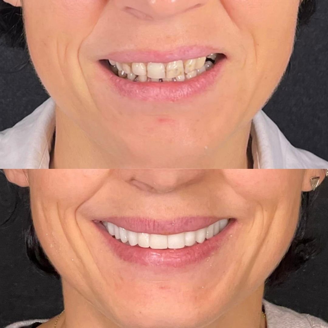 Patient Result