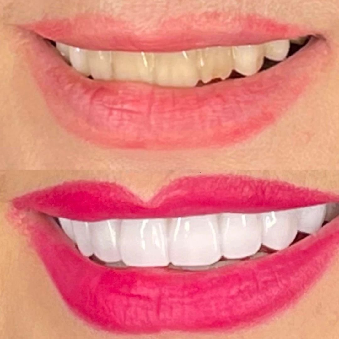 Patient Result